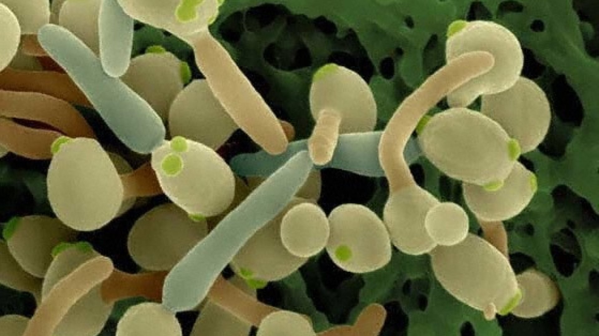 Hétköznapi tünetekbe bújava betegít meg a Candida-gomba! Mit kell tudnunk a Candida fertőzésről?