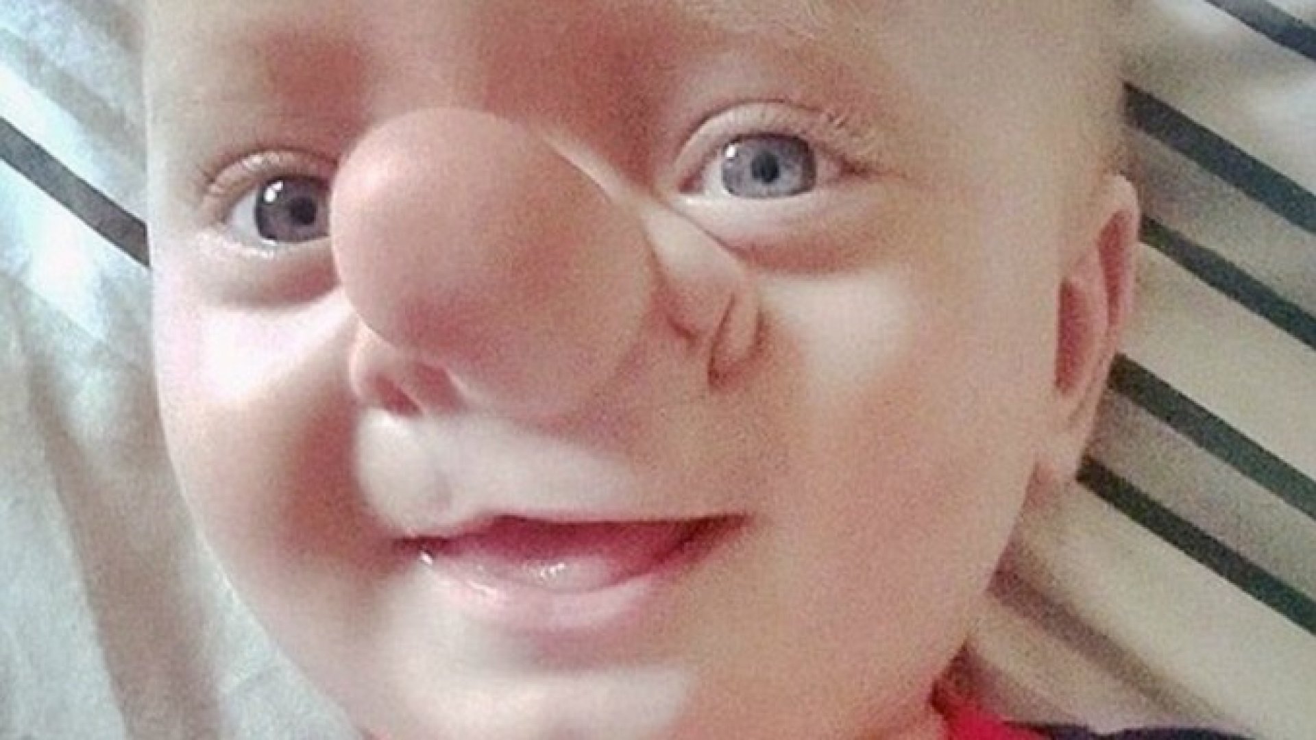 Az élő Pinokkió - különös születési rendellenességgel jött világra ez a kisfiú Pinokkió orrú kisbaba