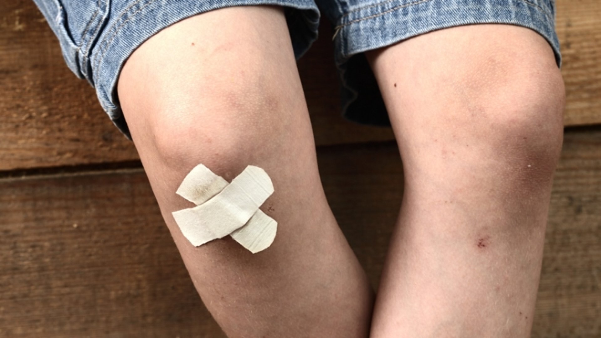 Horzsolások és vérző sebek ellátása