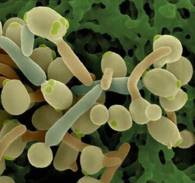 Hétköznapi tünetekbe bújava betegít meg a Candida-gomba! Mit kell tudnunk a Candida fertőzésről?