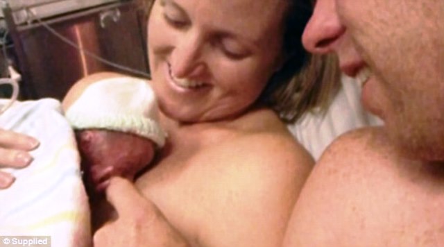 Nézd meg te is, mi történt a koraszülött kisbabával Olyan dolog történt a koraszülött babával, hogy nem hitték el